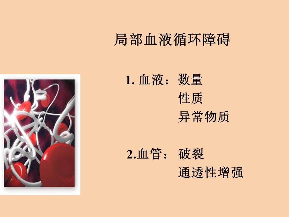 局部循环障碍.ppt_第2页