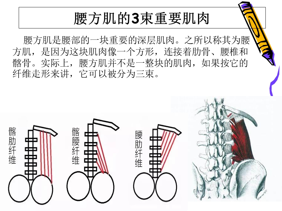 处理腰方肌受损.ppt_第3页