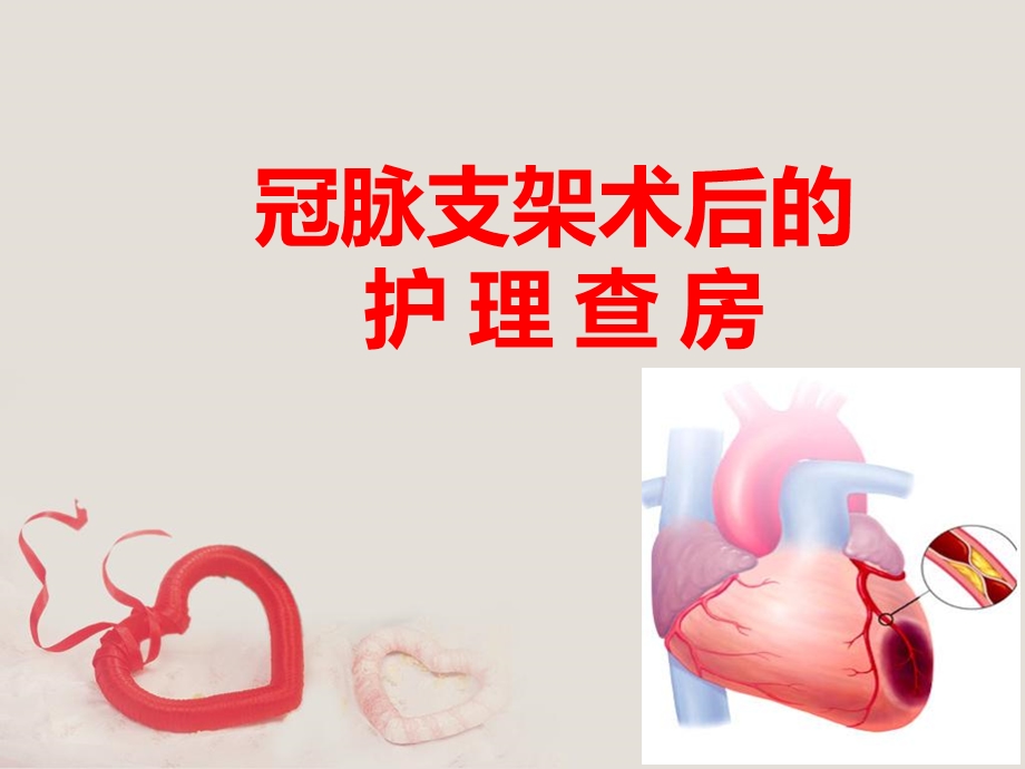 冠脉支架术后护理.ppt_第1页