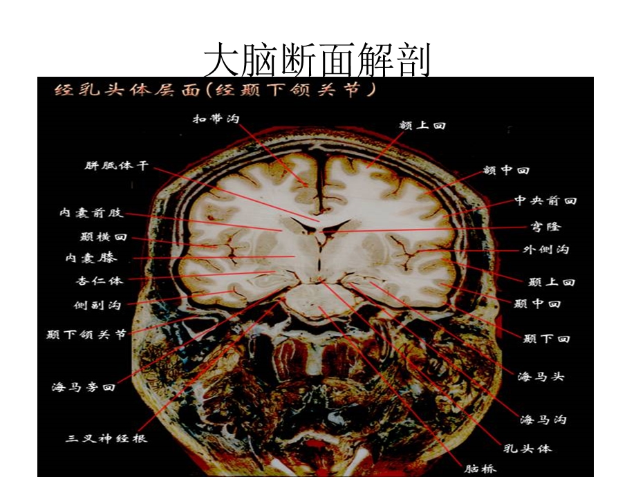 大脑结构图图例.ppt_第2页