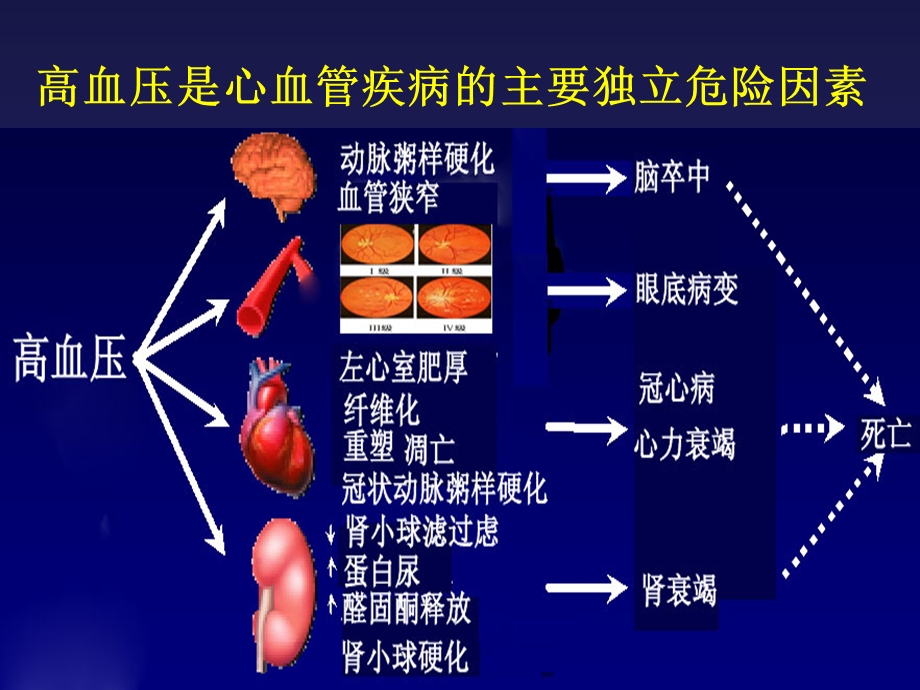 冠心病合并高血压的生活管理与药物治疗.ppt_第2页