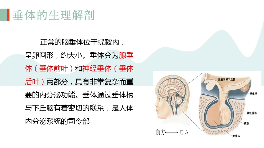 垂体瘤术后护理查房.ppt_第3页