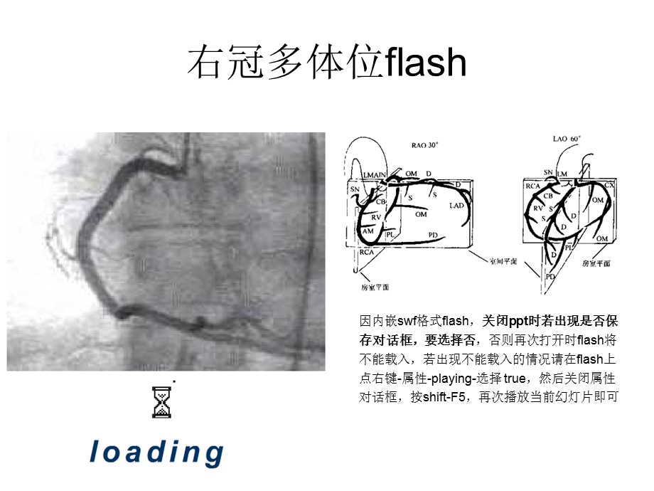 冠脉造影读片入门.ppt_第3页