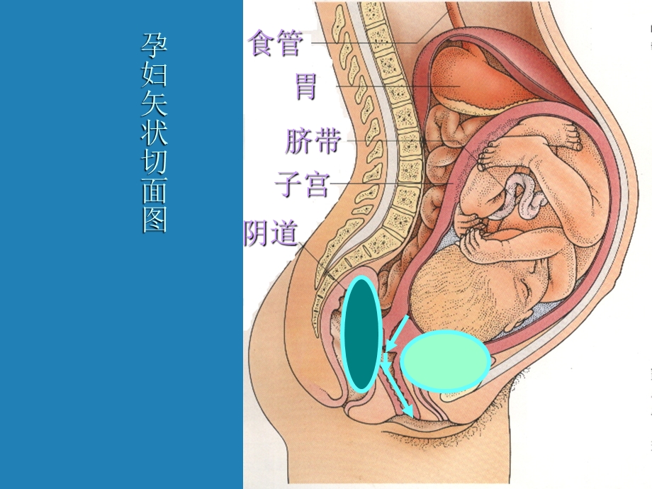 分娩期妇女护理-课件.ppt_第3页