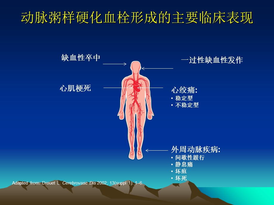 冠心病治疗方法的选择.ppt_第3页