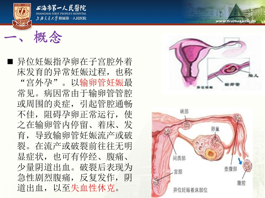 妊娠腹腔大出血的抢救配合.ppt_第2页