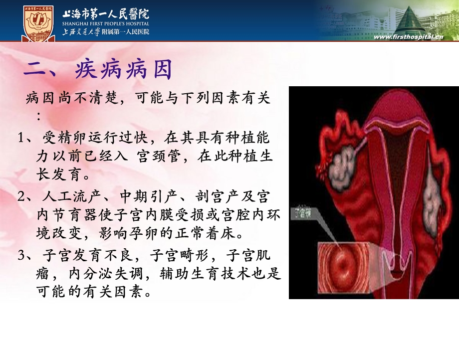 宫颈妊娠业务学习.ppt_第3页