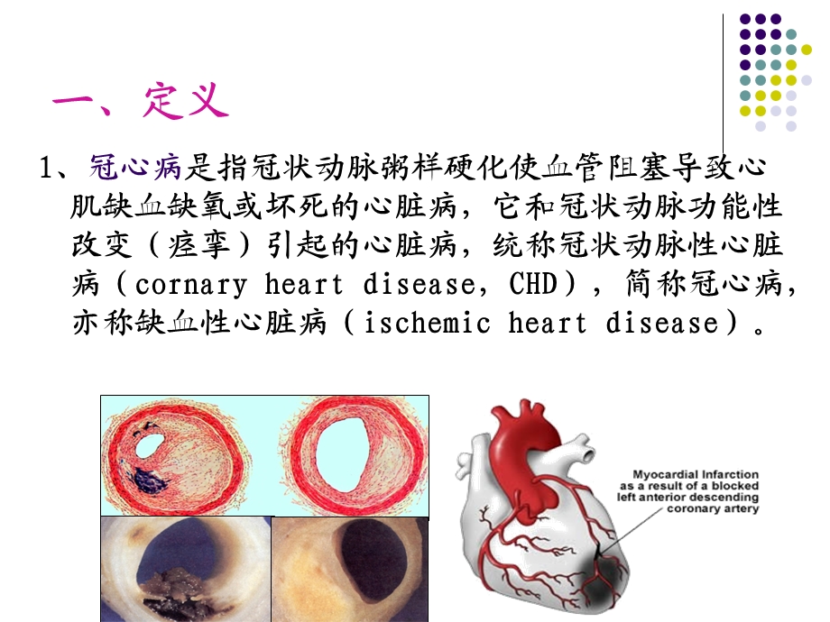 冠状动脉粥样硬化性.ppt_第2页