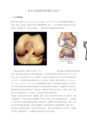 前交叉韧带损伤的预防与治疗.docx