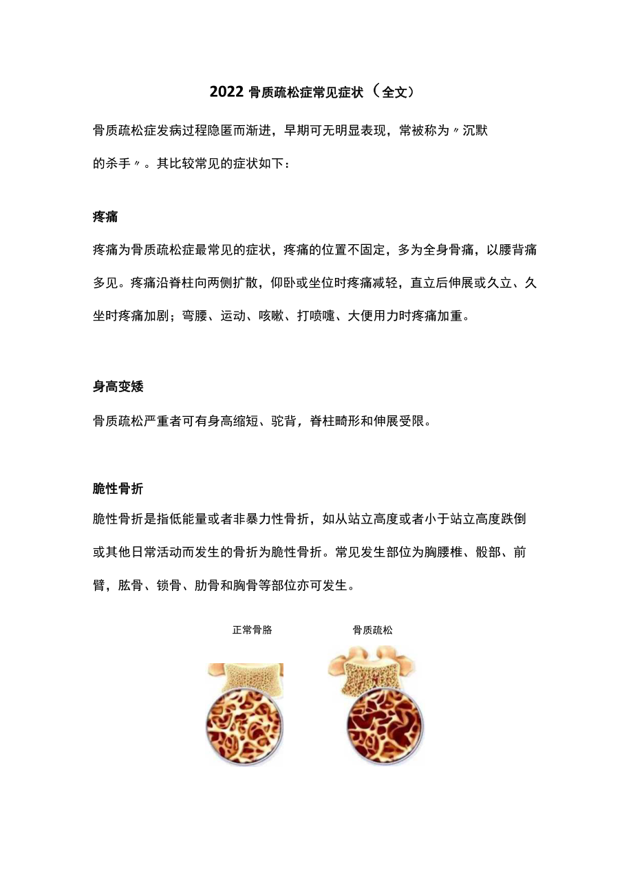 2022骨质疏松症常见症状（全文）.docx_第1页