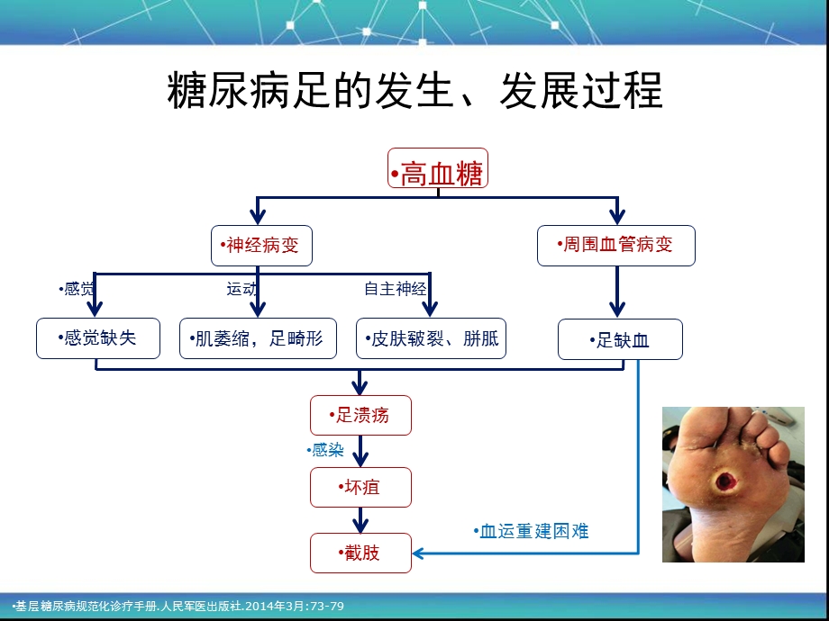 中国糖尿病足诊治指南.ppt_第2页