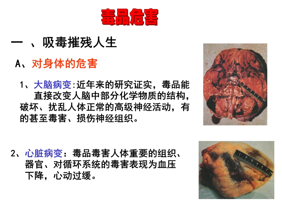 班会课课件：珍爱生命_远离毒品.ppt_第2页