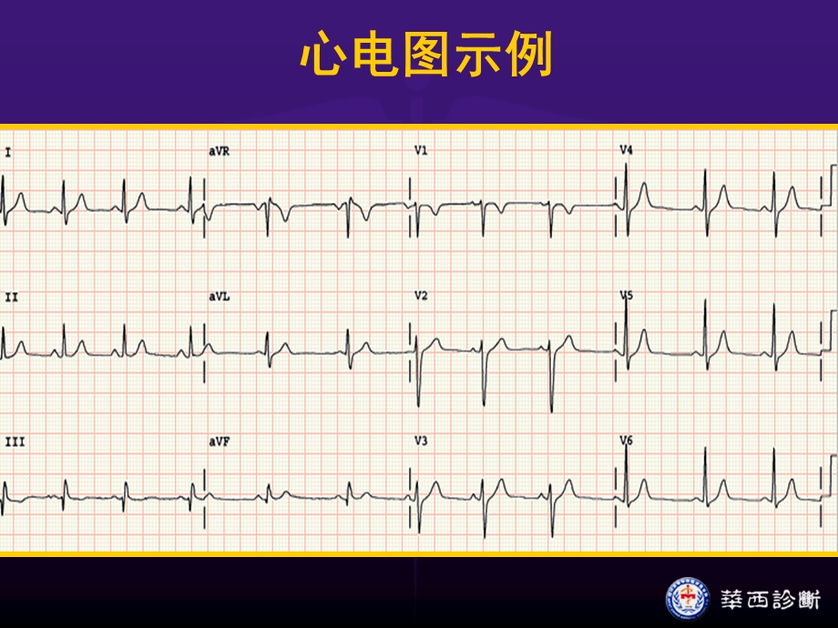 心电图学基础文档资料.ppt_第1页