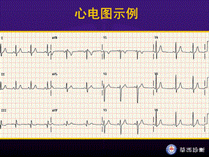 心电图学基础文档资料.ppt