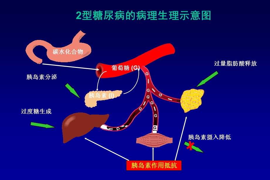 最新：2型糖尿病的治疗文档资料文档资料.ppt_第3页