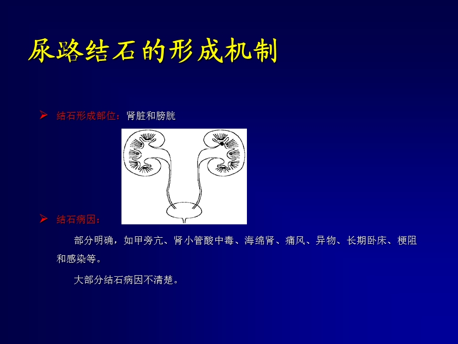 泌尿科 尿路结石课件文档资料.ppt_第3页