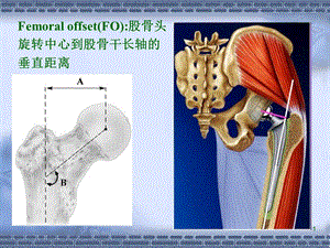 最新ppt正常髋关节股骨偏心距的影像学研究PPT文档.ppt