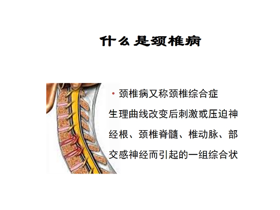 专家图解颈椎病的预防与保健精选文档.ppt_第1页