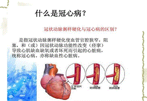 张晶pci术的护理查房文档资料.ppt