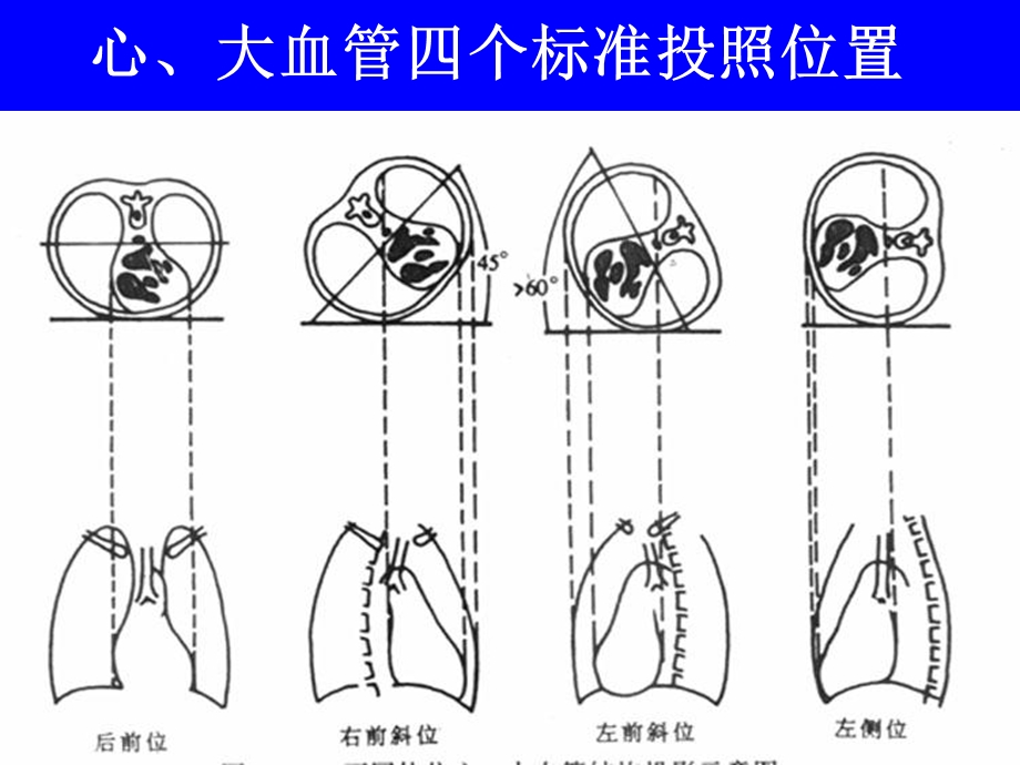 心与大血管系统影像诊断学文档资料.ppt_第2页