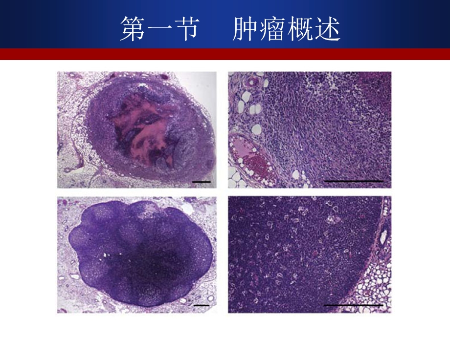 抗肿瘤药物文档资料.ppt_第1页