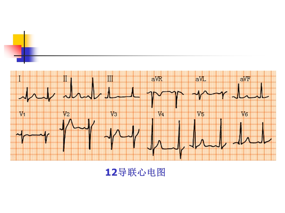 王心电图说文解字一——心电图基础知识ppt课件文档资料.ppt_第1页