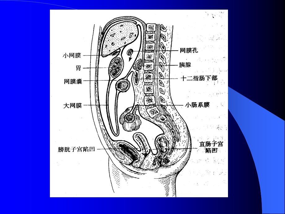 急性化脓性腹膜炎欧阳斌文档资料.ppt_第2页