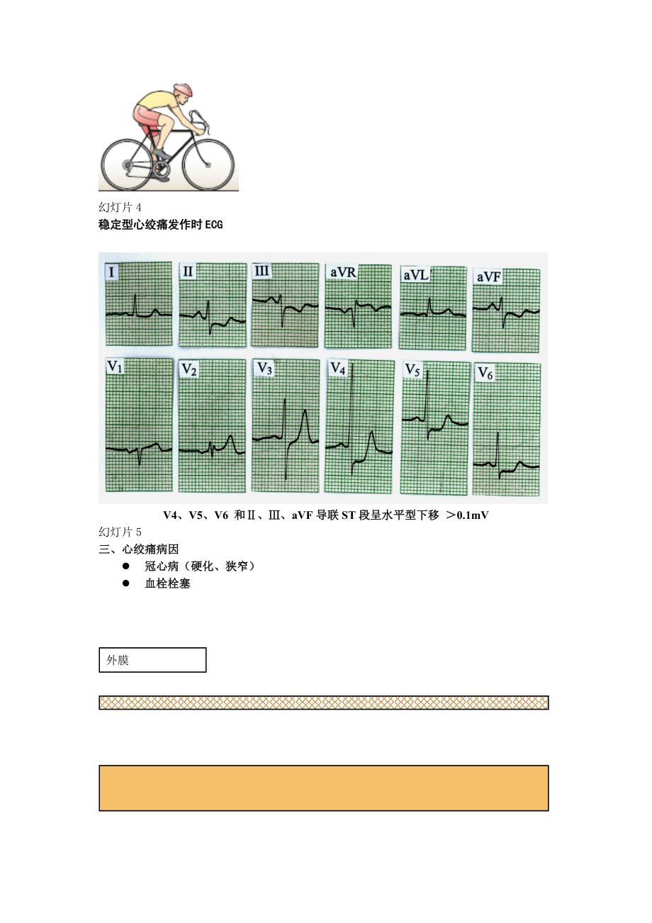 [临床医学]28抗心绞痛药.doc_第2页