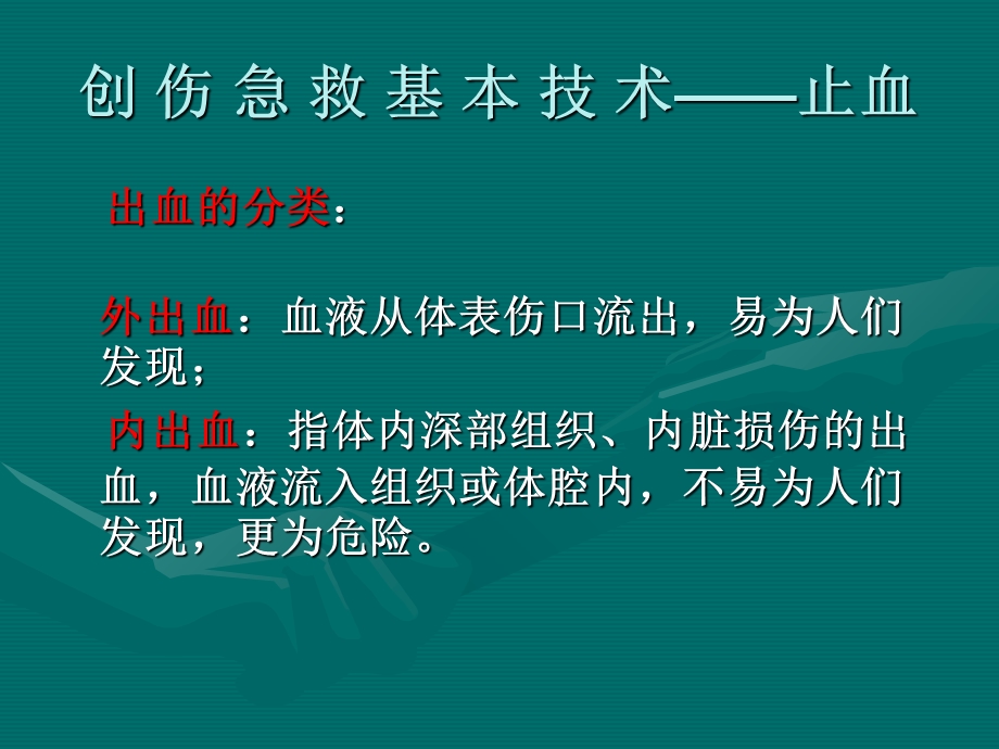 创伤急救基本技术文档资料.ppt_第2页