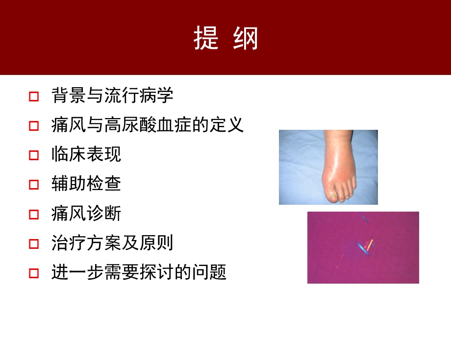 最新：中国痛风临床诊治指南解读文档资料文档资料.ppt_第1页