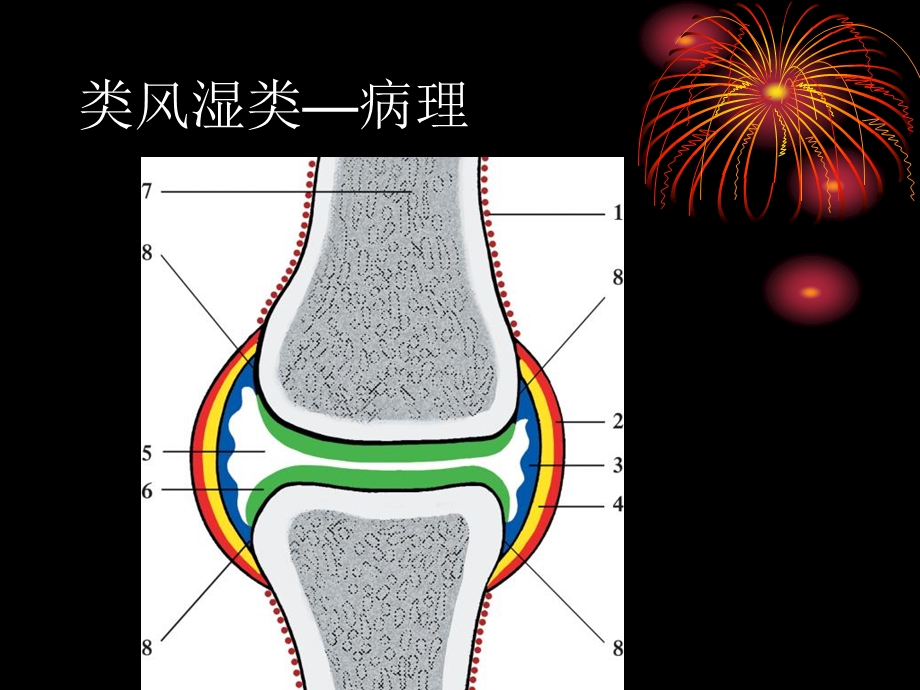 手足小关节病影像诊断文档资料.ppt_第3页