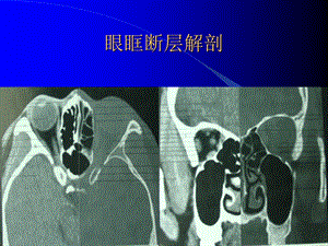 影像学03头颈部文档资料.ppt