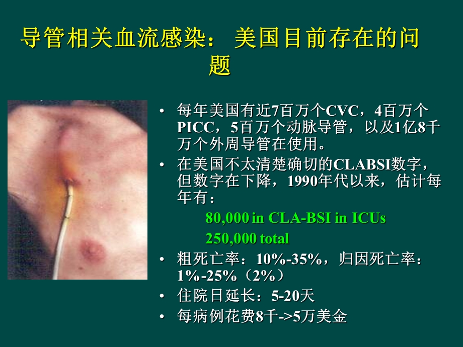 最新：美国导管相关血流感染预防与控制技术指南的解析文档资料.ppt_第1页