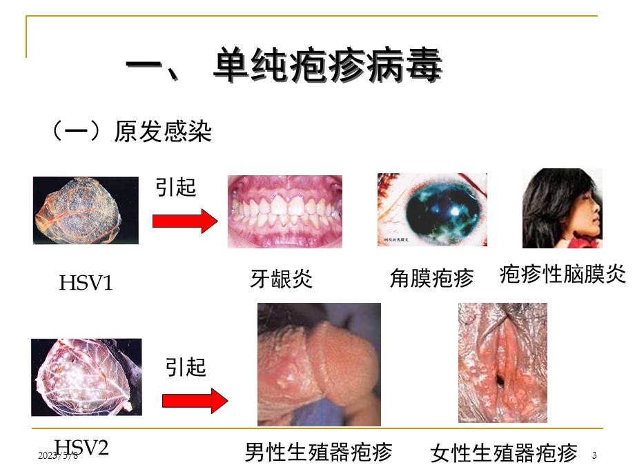 三十一章其它病毒及朊粒文档资料.ppt_第3页