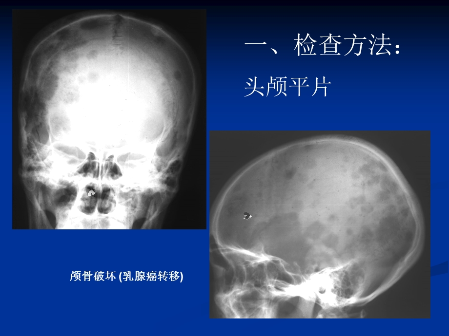 颅脑影像神内精选文档.ppt_第2页