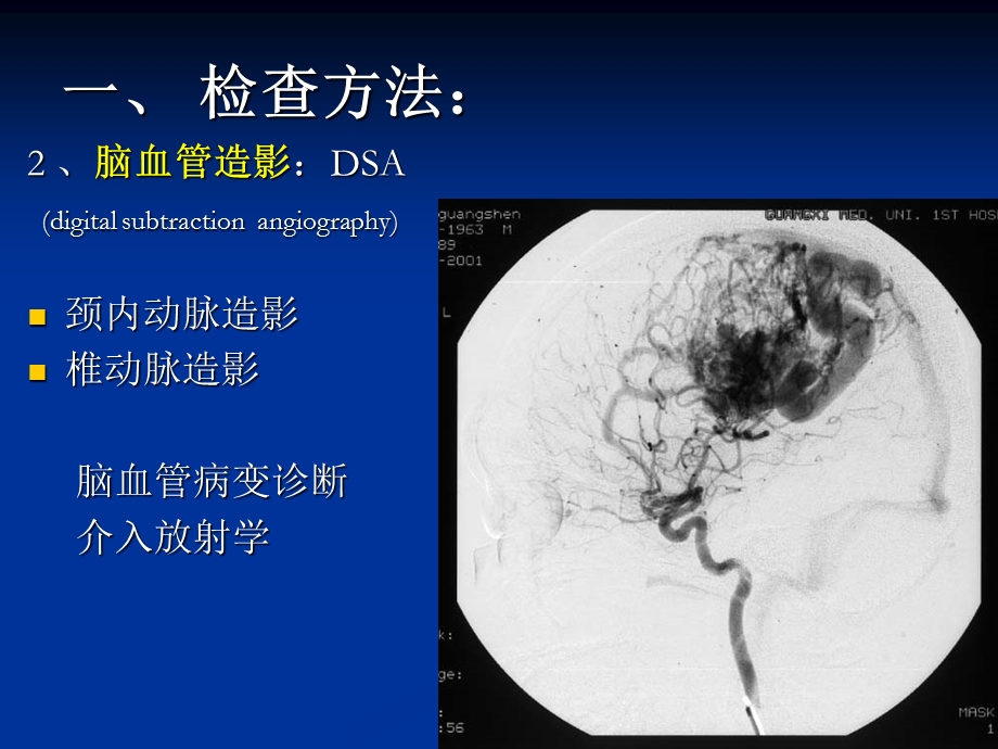 颅脑影像神内精选文档.ppt_第3页