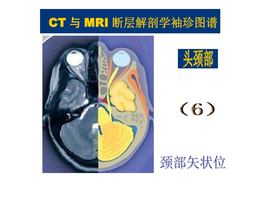 头颈CTMRI解剖图解系列6.ppt_第2页