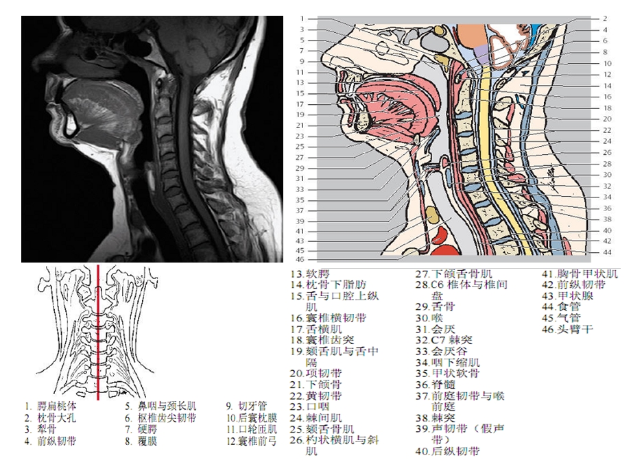 头颈CTMRI解剖图解系列6.ppt_第3页