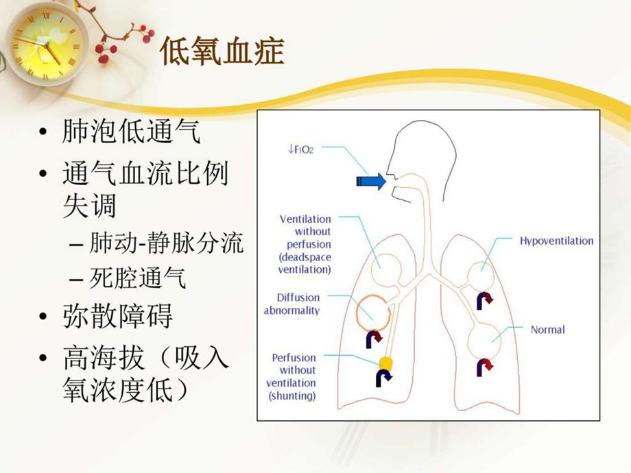 神经肌肉疾病患者的机械通气图文.ppt.ppt_第3页