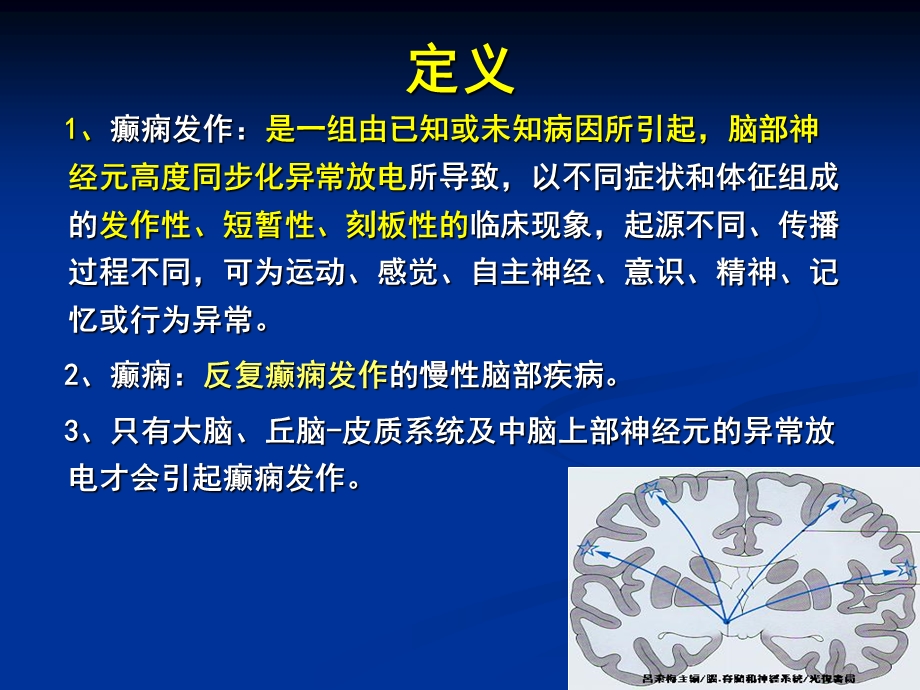 癫痫神经病学刘军ppt课件.ppt_第2页