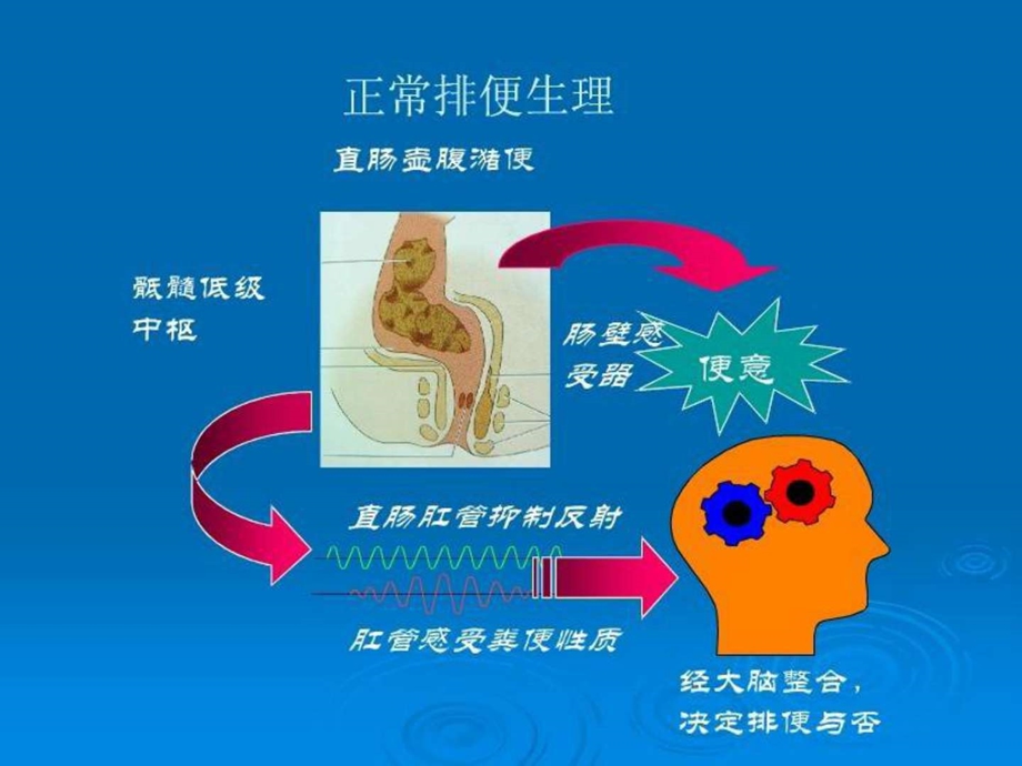 先天性巨结肠图文.ppt.ppt_第3页