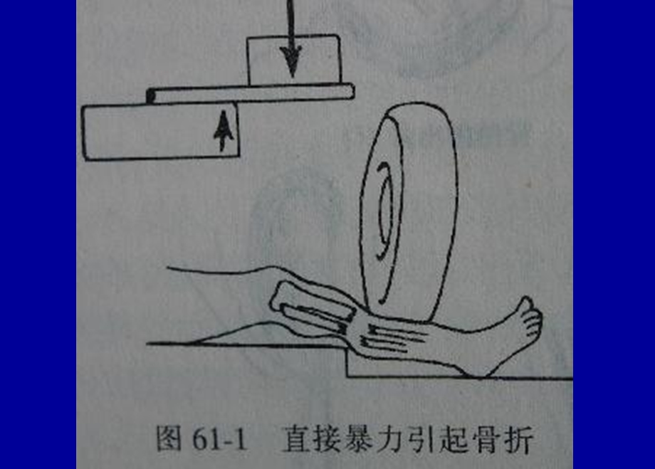 骨科总论ppt课件文档资料.ppt_第3页