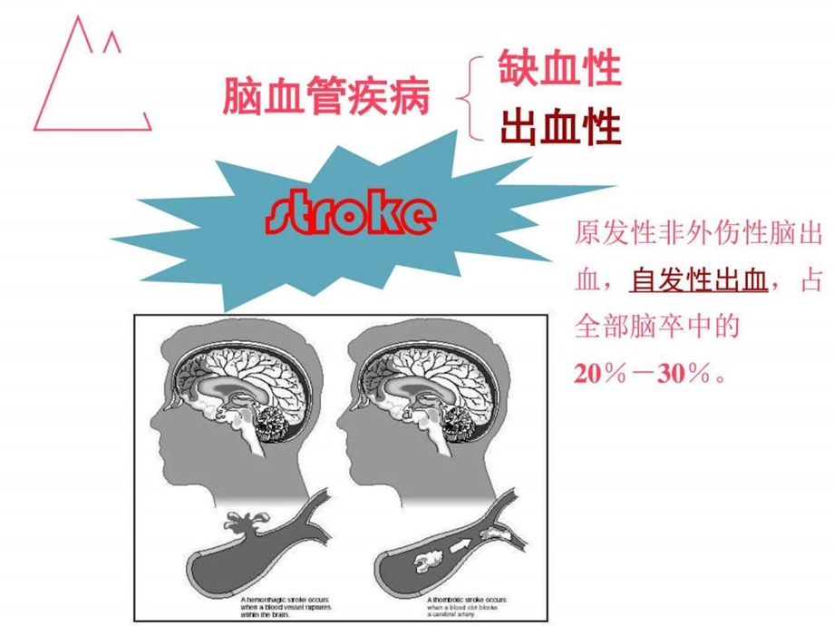 脑出血ppt课件图文1504263515.ppt.ppt_第2页