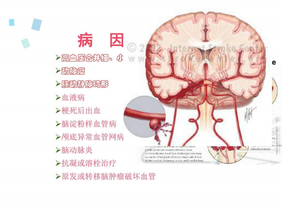 脑出血ppt课件图文1504263515.ppt.ppt_第3页