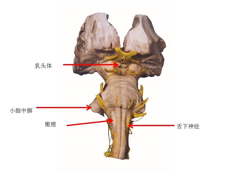 神经系统标本训练题文档资料.ppt_第1页