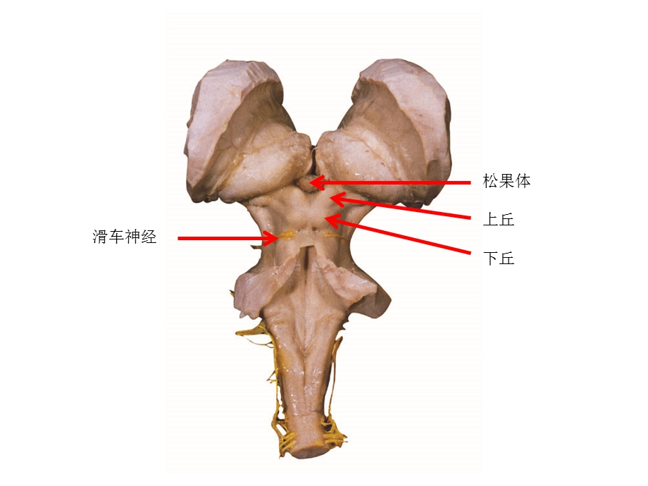 神经系统标本训练题文档资料.ppt_第2页