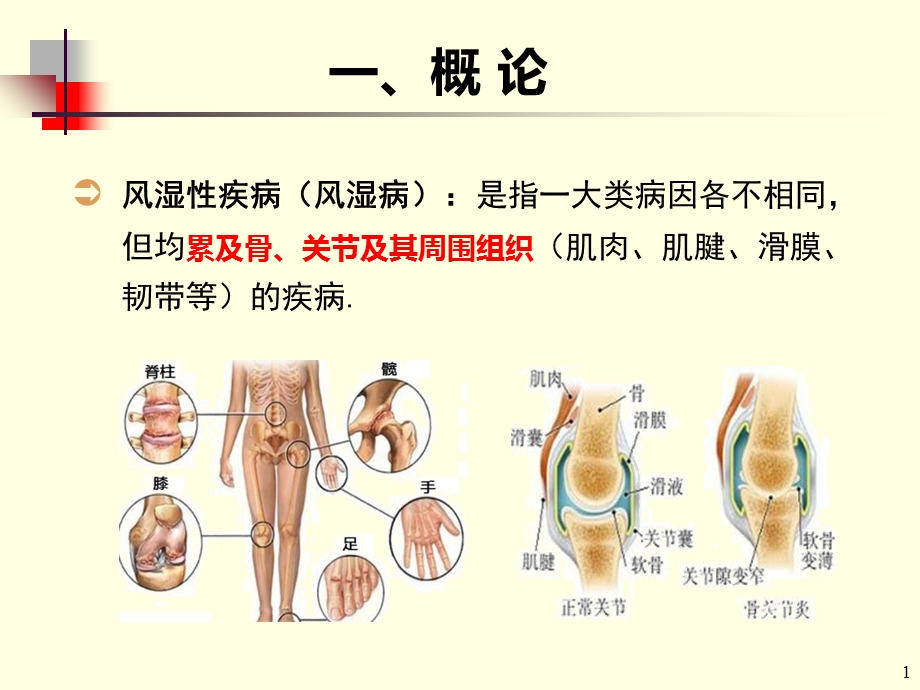 风湿概述文档资料.ppt_第1页