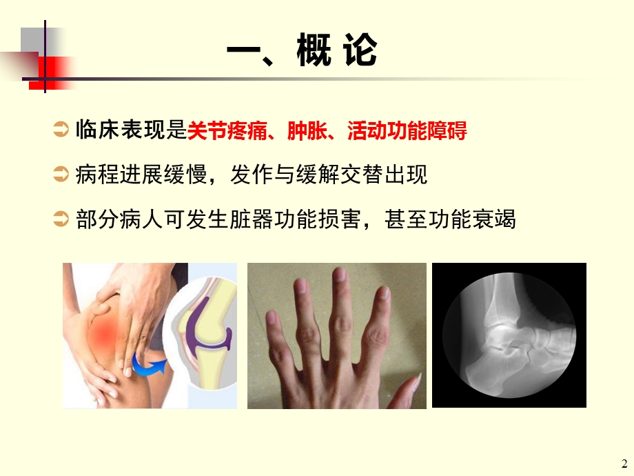 风湿概述文档资料.ppt_第2页