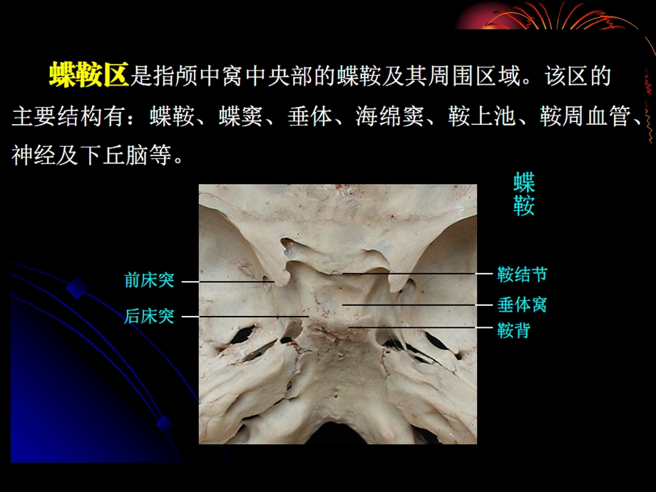 鞍区解剖精选文档.ppt_第3页