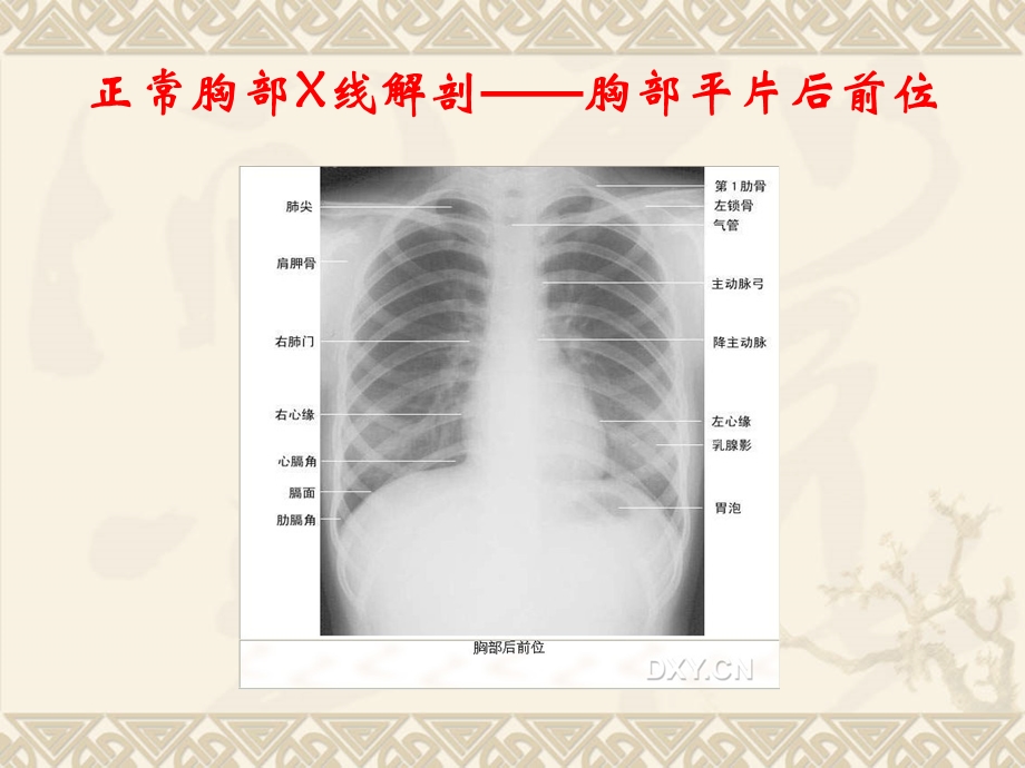 X线正常解剖基础精华.ppt_第3页